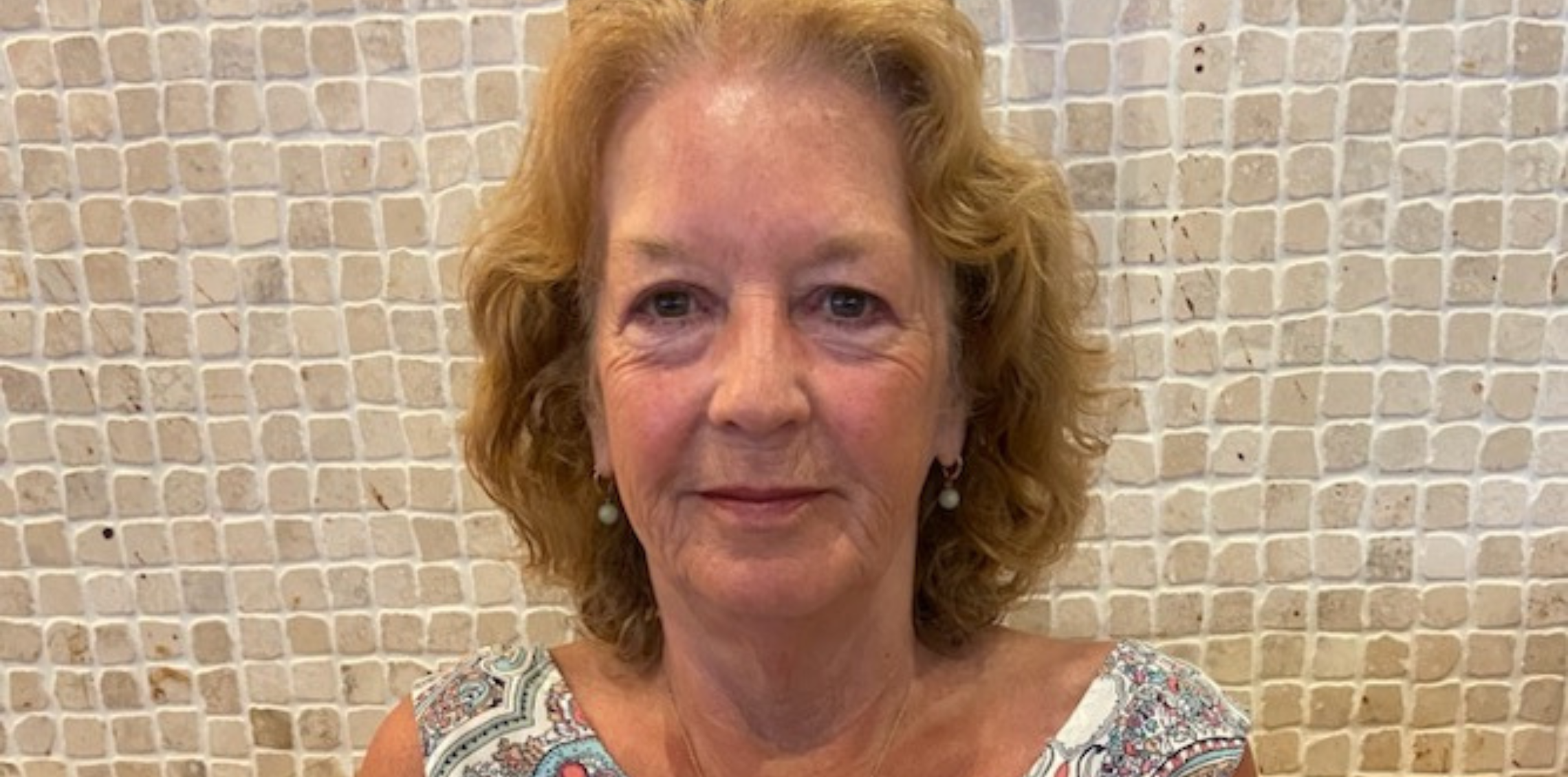 Sandra is global first recruit to stent research study following heart attack