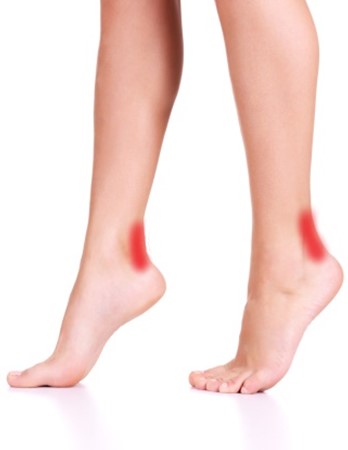 Did You Know That Flat Feet Can Cause Back, Hip, and Knee Pain?: South  Sound Foot & Ankle: Podiatric Medicine and Surgery